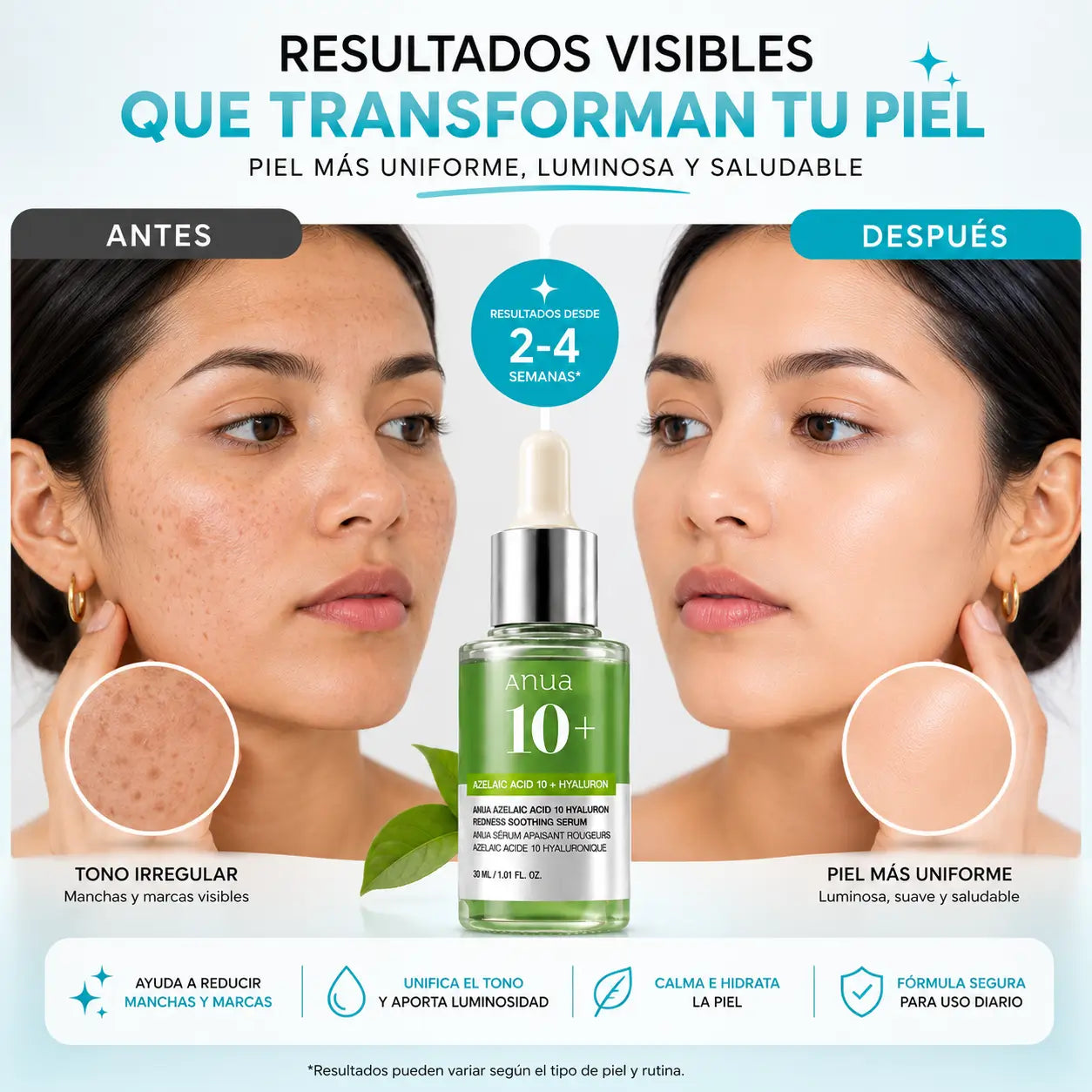 Serum Facial Azelaico – Reduce Manchas y Marcas de la Piel