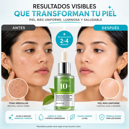 Serum Facial Azelaico – Reduce Manchas y Marcas de la Piel